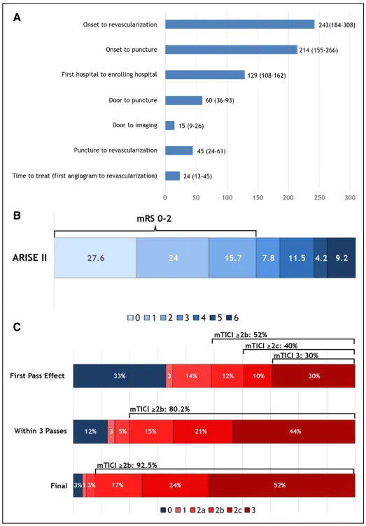 Primární výsledky multicentrické studie ARISE II (Analýza revascularizace u ischemické mrtvice s EmboTrap)