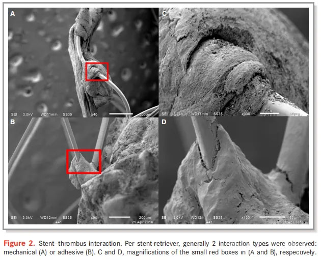  Interakce stent-trombus